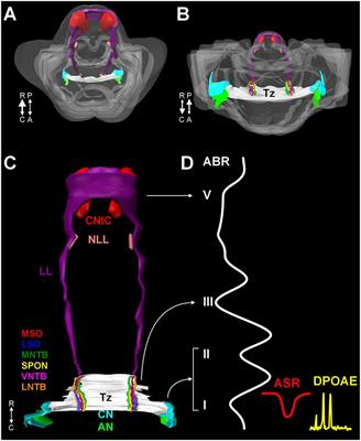 Central Auditory and Vestibular Dysfunction Are Key Features of Autism Spectrum Disorder